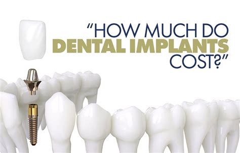 cost-effective dental implant options